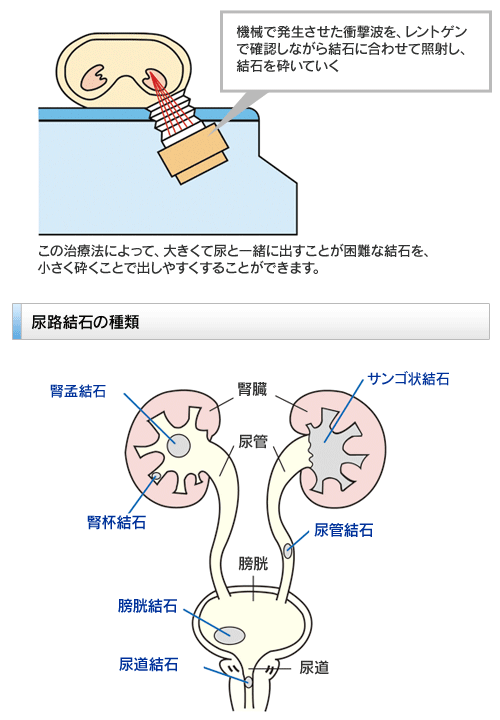 ̊OՌgΔjӏpCXg